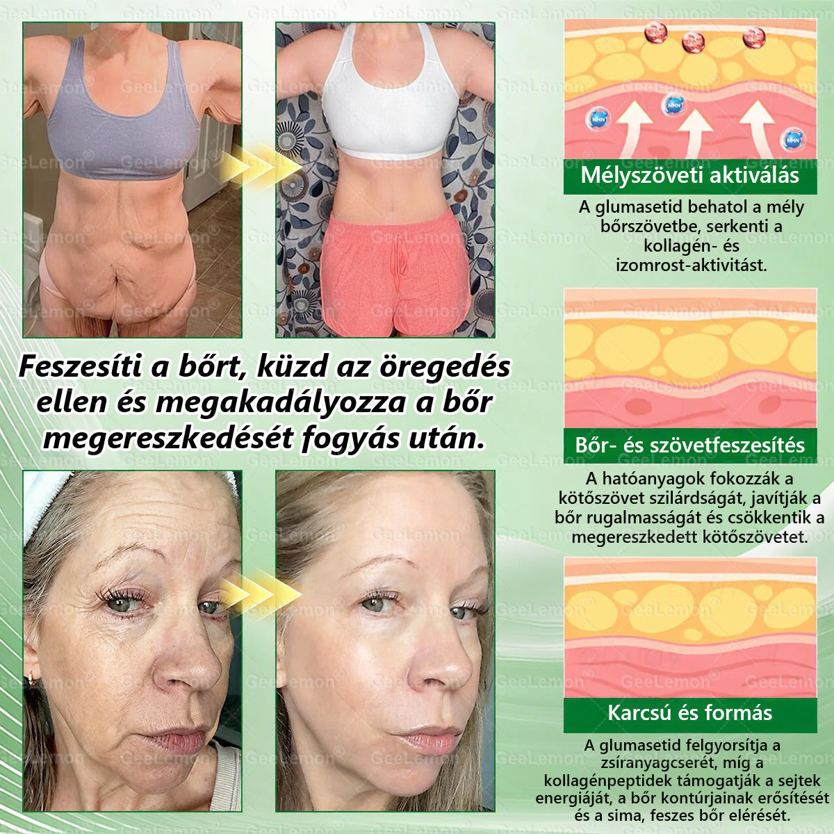 🌿Hivatalos bolt | 𝐆𝐞𝑒𝐿𝑒𝐦𝐨𝐧® Glumasetide 8 az 1-ben Karcsú és Egészséges Nano Mikrotűs Tapasz (Napi 1×, látható változás 7 nap alatt) Berberin + Moringa ✅ Elhízásra, laza bőrre, cukorbetegségre, alvási apnoéra, ízületekre stb. 💥💥🇭🇺