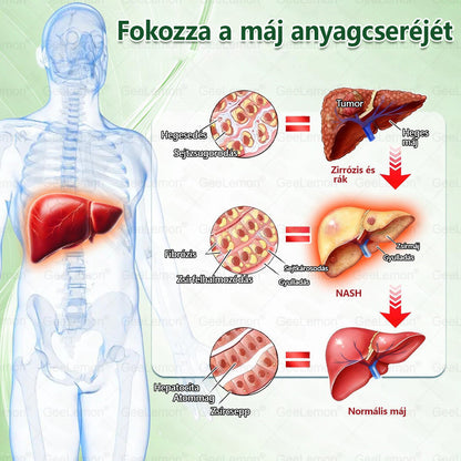 🌿Hivatalos bolt | 𝐆𝐞𝑒𝐿𝑒𝐦𝐨𝐧® Glumasetide 8 az 1-ben Karcsú és Egészséges Nano Mikrotűs Tapasz (Napi 1×, látható változás 7 nap alatt) Berberin + Moringa ✅ Elhízásra, laza bőrre, cukorbetegségre, alvási apnoéra, ízületekre stb. 💥💥🇭🇺