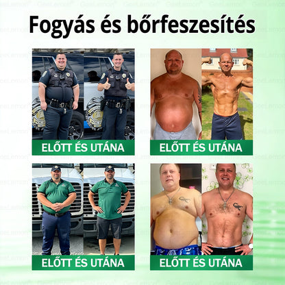 🌿Hivatalos bolt | 𝐆𝐞𝑒𝐿𝑒𝐦𝐨𝐧® Glumasetide 8 az 1-ben Karcsú és Egészséges Nano Mikrotűs Tapasz (Napi 1×, látható változás 7 nap alatt) Berberin + Moringa ✅ Elhízásra, laza bőrre, cukorbetegségre, alvási apnoéra, ízületekre stb. 💥💥🇭🇺