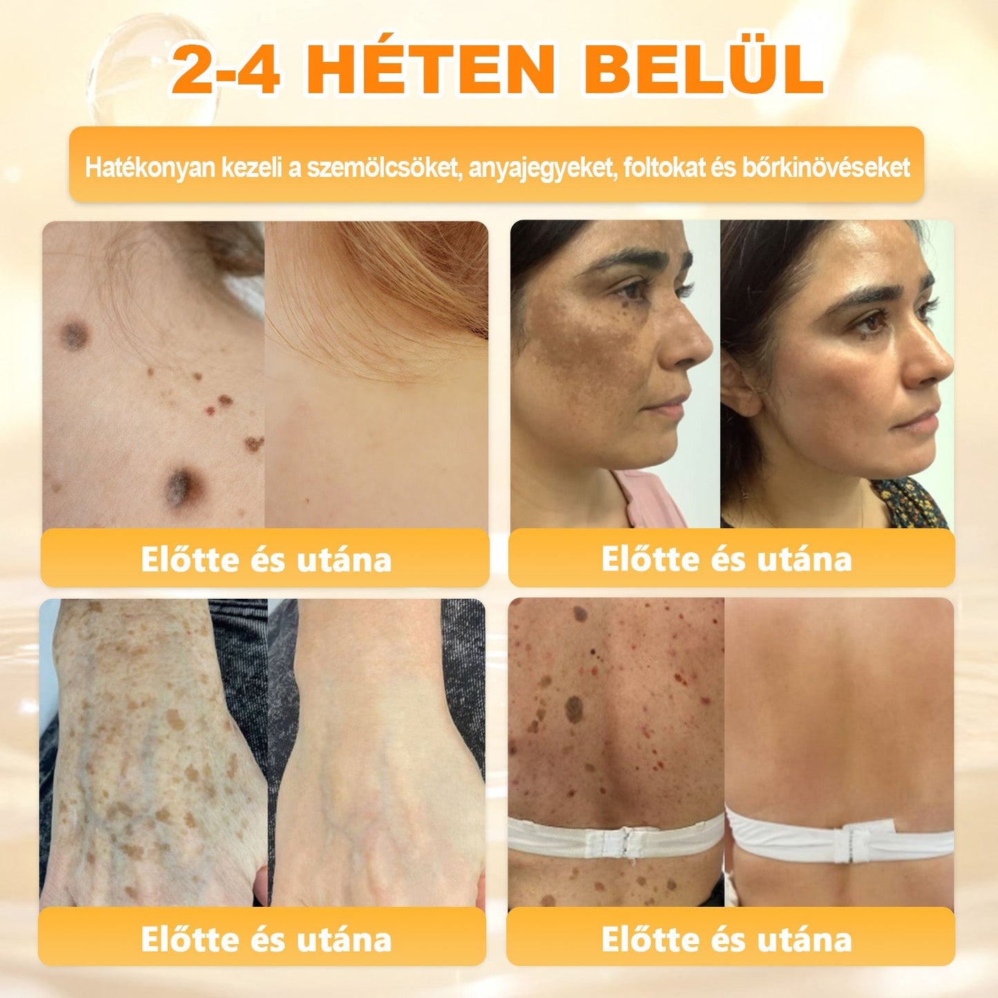 Ajánlott a Semmelweis Kórház által · BENU hivatalos üzlet✨✨ 𝖠𝖯𝖪𝖠𝖯𝖪® méhméreges bőrmegújító krém