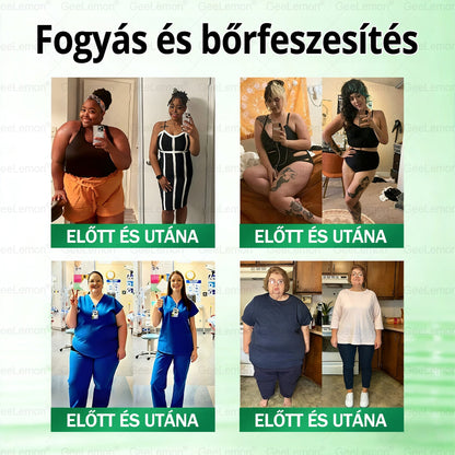 🌿Hivatalos bolt | 𝐆𝐞𝑒𝐿𝑒𝐦𝐨𝐧® Glumasetide 8 az 1-ben Karcsú és Egészséges Nano Mikrotűs Tapasz (Napi 1×, látható változás 7 nap alatt) Berberin + Moringa ✅ Elhízásra, laza bőrre, cukorbetegségre, alvási apnoéra, ízületekre stb. 💥💥🇭🇺