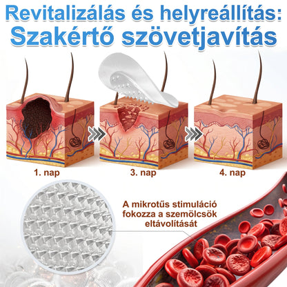 ✨✨✨PURESHADE® 2 az 1-ben mikrotűs és hidrokolloid tapasz🍀 | Kiálló anyajegyek, aknék, lapos szemölcsök és bőrnövedékek eltávolítására | Segít csökkenteni a ráncokat, hegeket és bőrhibákat | Láthatatlan tapasz az arcra és testre