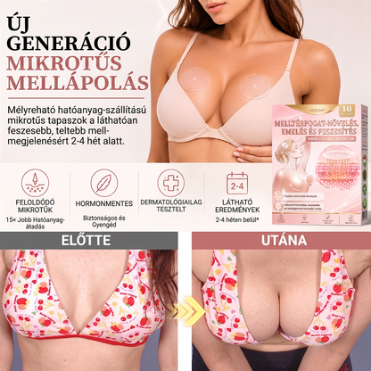 🥇HISKIN® MELLEMELŐ ÉS FESZESÍTŐ MIKROTŰS TAPASZOK