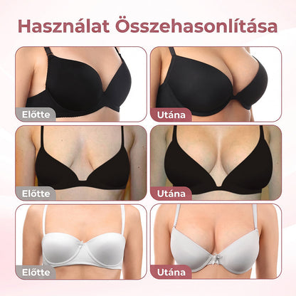 🥇HISKIN® MELLEMELŐ ÉS FESZESÍTŐ MIKROTŰS TAPASZOK