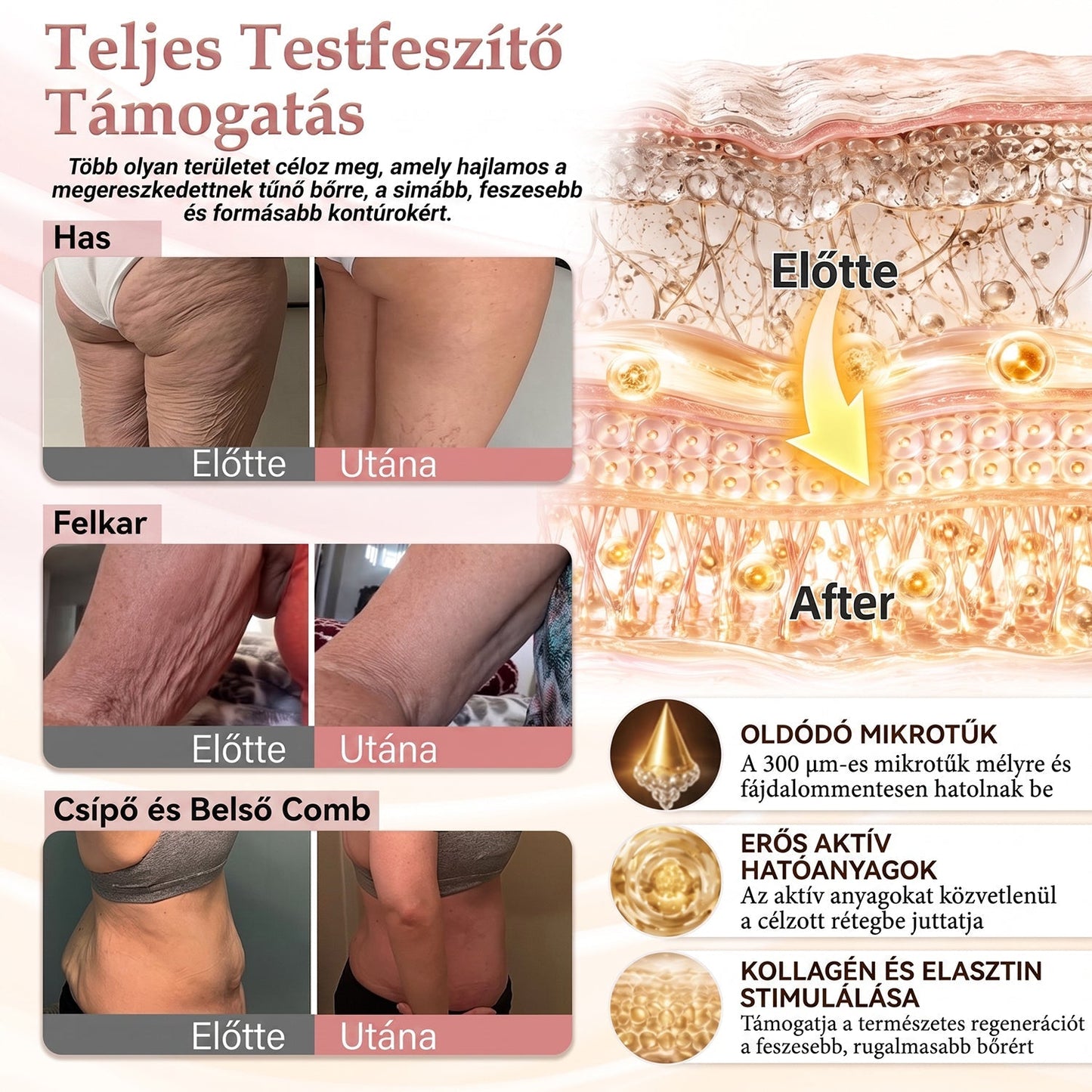 🥇HISKIN® MELLEMELŐ ÉS FESZESÍTŐ MIKROTŰS TAPASZOK