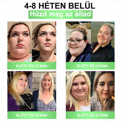 🌿Hivatalos bolt | 𝐆𝐞𝑒𝐿𝑒𝐦𝐨𝐧® Glumasetide 8 az 1-ben Karcsú és Egészséges Nano Mikrotűs Tapasz (Napi 1×, látható változás 7 nap alatt) Berberin + Moringa ✅ Elhízásra, laza bőrre, cukorbetegségre, alvási apnoéra, ízületekre stb. 💥💥🇭🇺