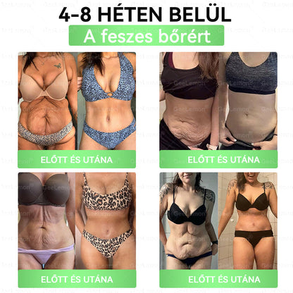 🌿Hivatalos bolt | 𝐆𝐞𝑒𝐿𝑒𝐦𝐨𝐧® Glumasetide 8 az 1-ben Karcsú és Egészséges Nano Mikrotűs Tapasz (Napi 1×, látható változás 7 nap alatt) Berberin + Moringa ✅ Elhízásra, laza bőrre, cukorbetegségre, alvási apnoéra, ízületekre stb. 💥💥🇭🇺